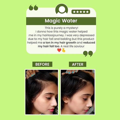 Rosemary Water, Hair Spray For Regrowth🌿  (Pack of 3)100ml